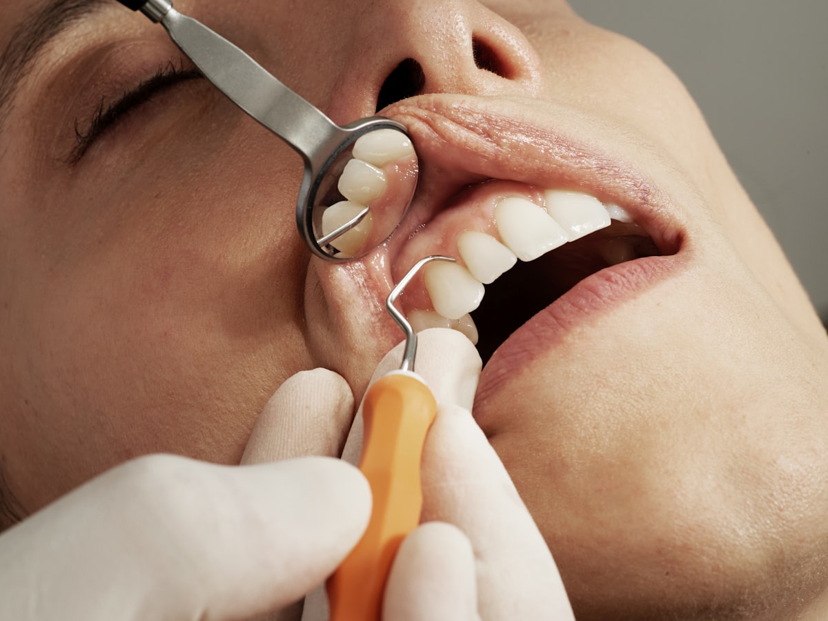 Periodontia em Viçosa - Dr. Guilherme Teixeira